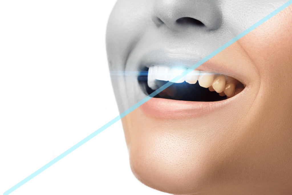 Why Oral Hygiene is Important? 3 Invisalign or Braces