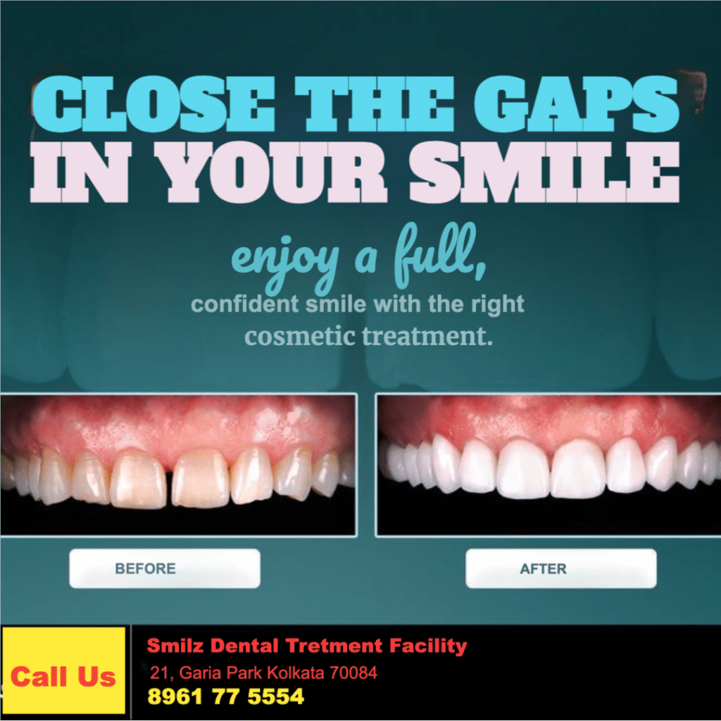 Diestema Treatment