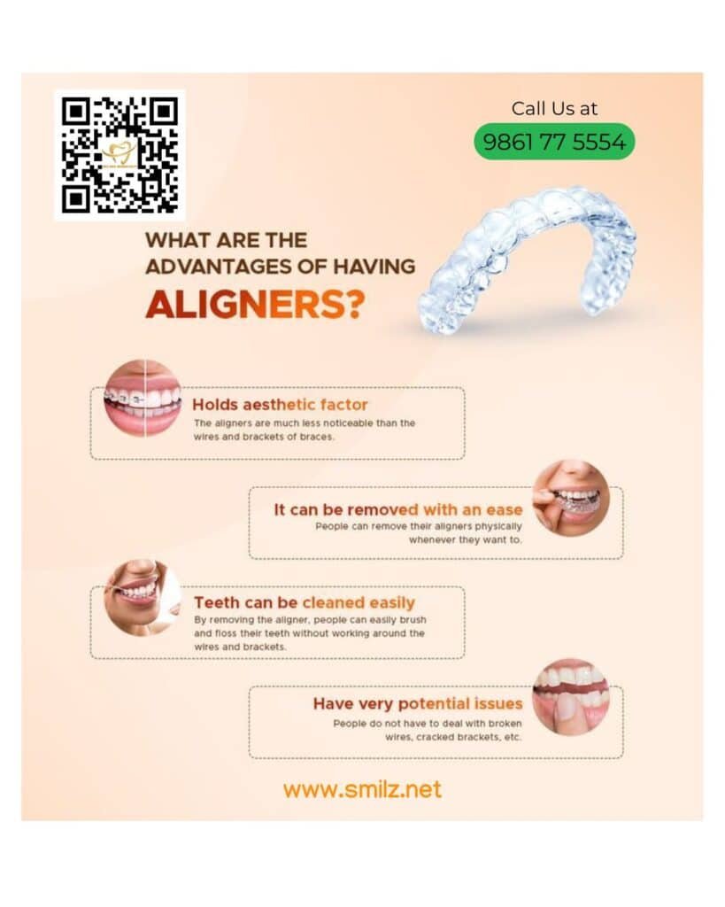 Aligners at Smilz