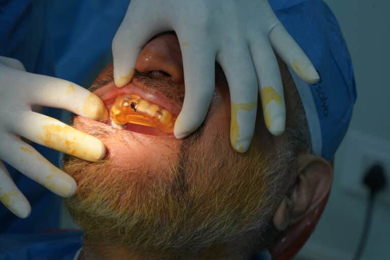 Guided Implant Placement: Precision, Comfort & Predictability in Modern Implant Dentistry